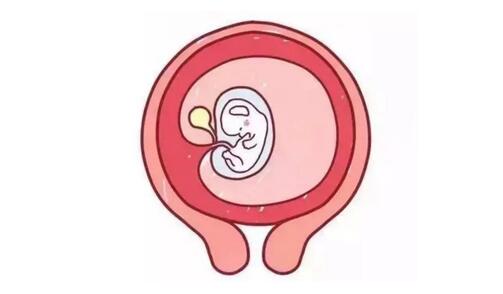 孕囊形状看性别准不准