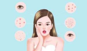 多囊卵巢综合症的症状有哪些？