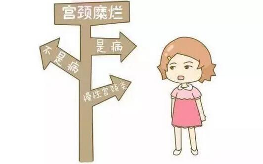 宫颈糜烂根本不是病