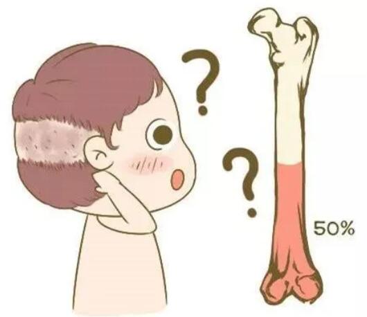 婴儿出现枕秃了？是缺钙了吗？