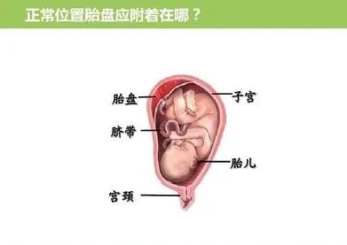 关于前置胎盘，你需要了解的事儿