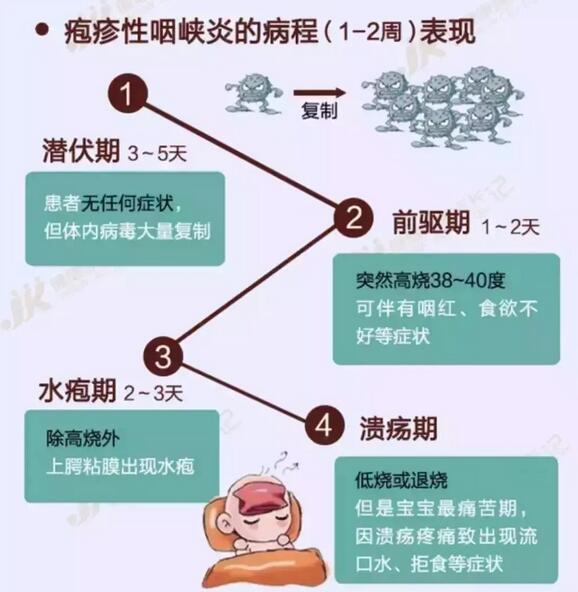 如何防治疱疹性咽峡炎