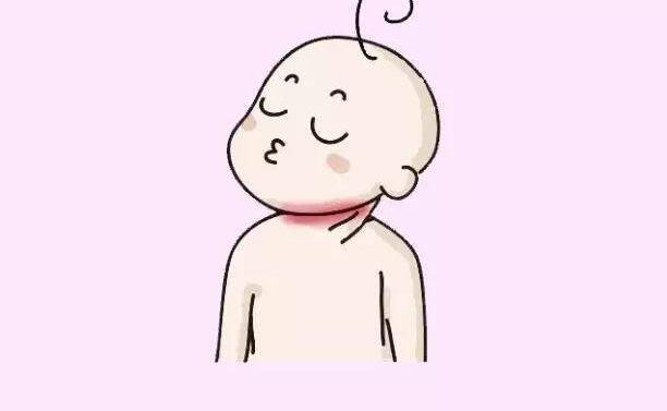 夏天宝宝淹脖子，发红又破皮怎么办？