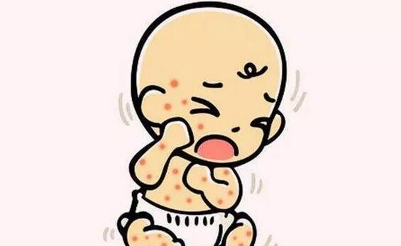宝宝湿疹怎么才能根除