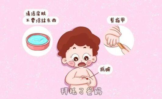 宝宝长痱子怎么办？止痒去痱记住9个字