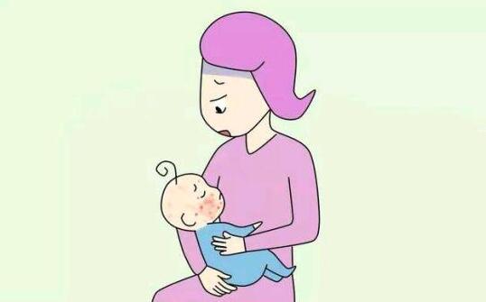 婴儿湿疹用什么药膏