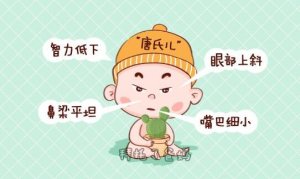 唐氏宝宝有什么特征？