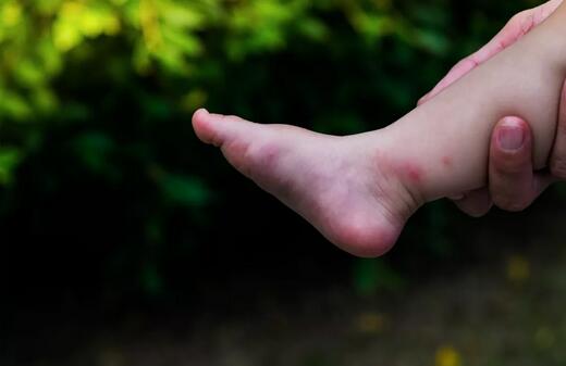 无比滴宝宝能用吗？哪些驱蚊产品靠谱？