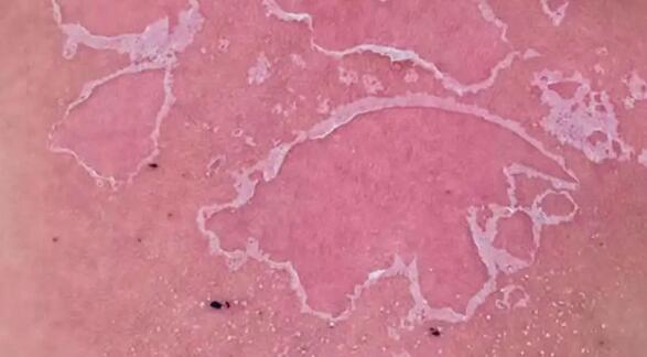 婴儿晒太阳补钙靠谱吗