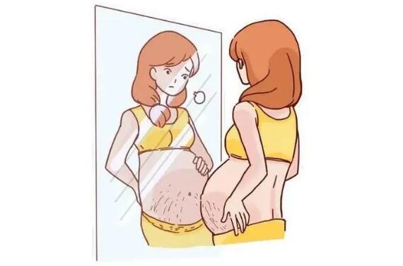 妊娠纹是什么