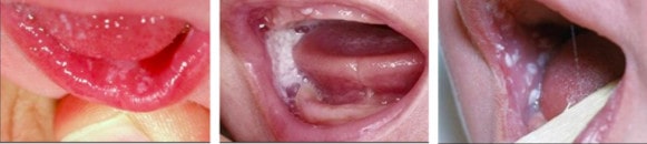 或不明原因哭闹