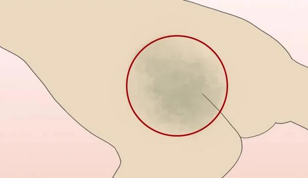 胎记是好东西嘛 做一个简单的归类