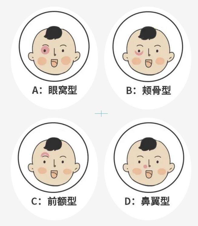 胎记是好东西嘛 做一个简单的归类