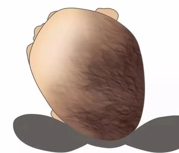 新生儿需要枕头吗？睡早了或睡不当都不好