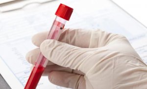 男性备孕注意事项