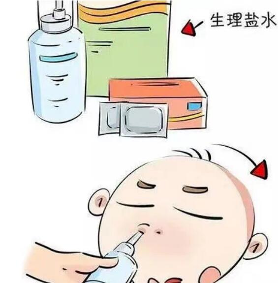 新生儿鼻塞怎么办