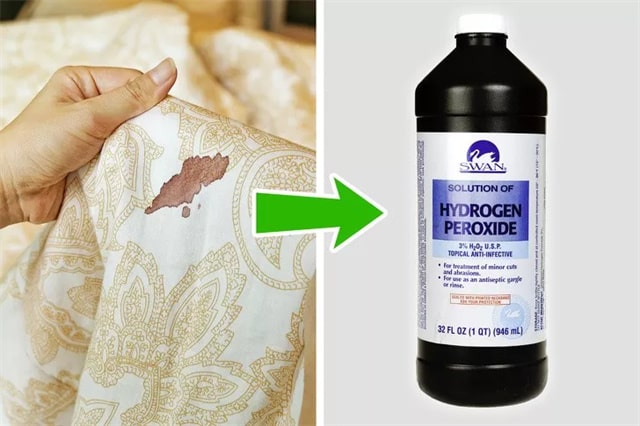 10招去污渍技巧，把衣服救回来