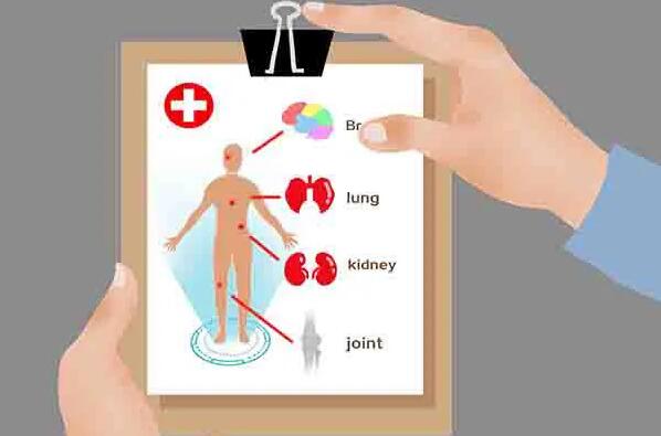 高血压诊断标准 怎样预防高血压