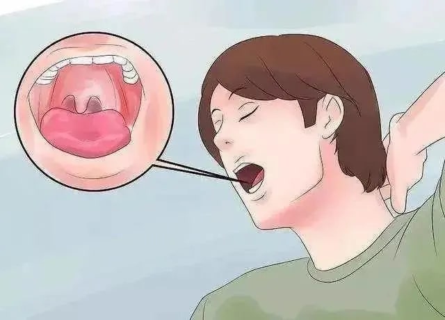 脑梗塞的原因和症状及预防