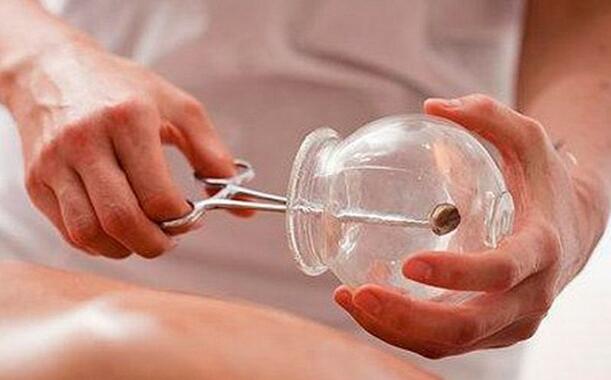 拔罐后黑紫是湿气重吗