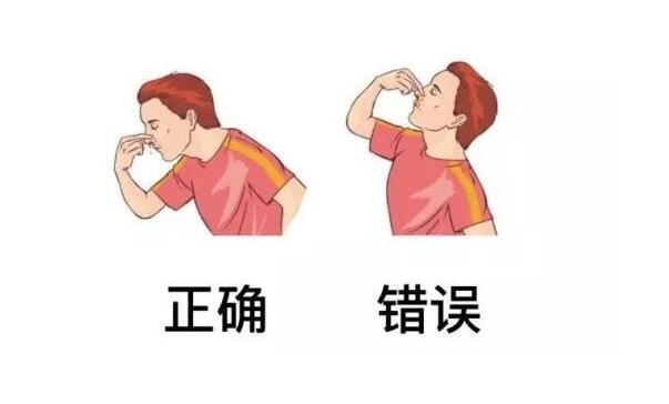 小孩流鼻血怎么处理