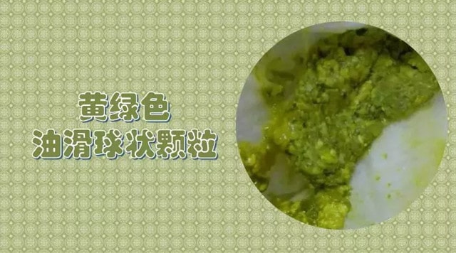 11种宝宝大便绿色的原因及改善方式