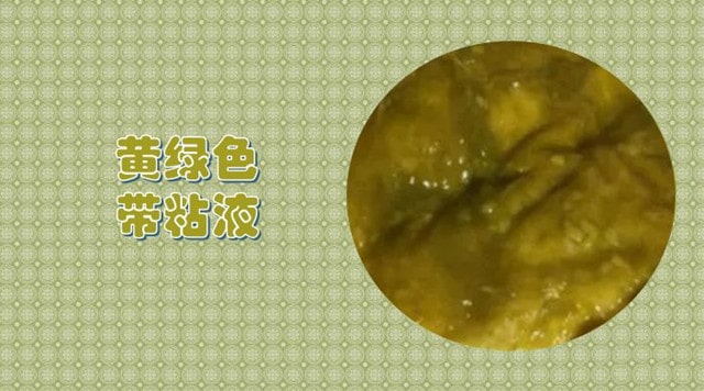11种宝宝大便绿色的原因及改善方式