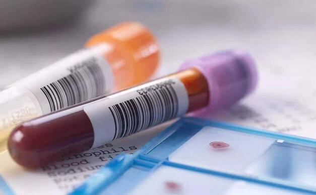 脐带血有必要保存吗