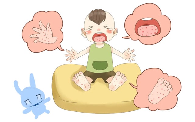 如何预防手足口病