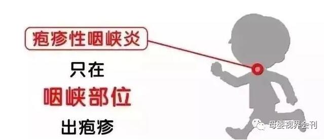 小儿疱疹性咽峡炎如何护理和预防