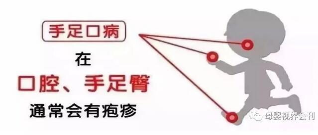 小儿疱疹性咽峡炎如何护理和预防