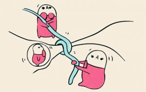 到底是男性结扎好，还是女性结扎好？