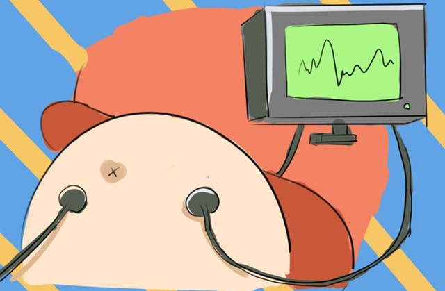 胎心监护图怎么看 能看男女吗