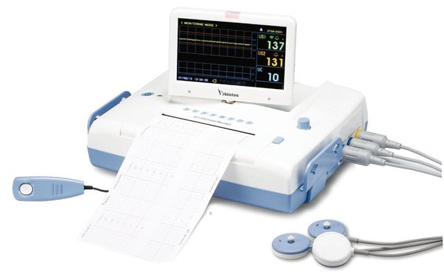 胎心监护图怎么看 能看男女吗