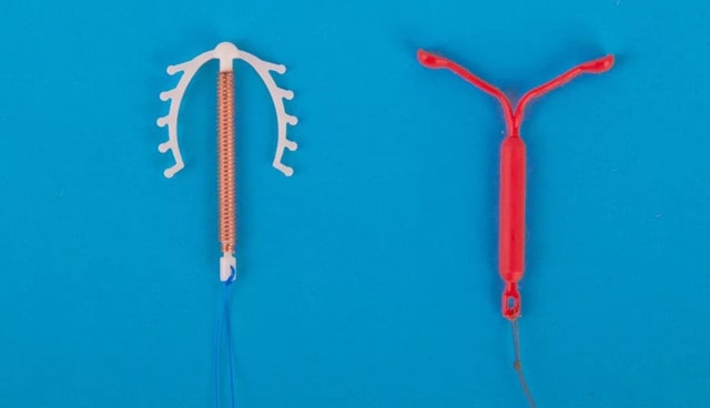 取环后多久可以怀孕