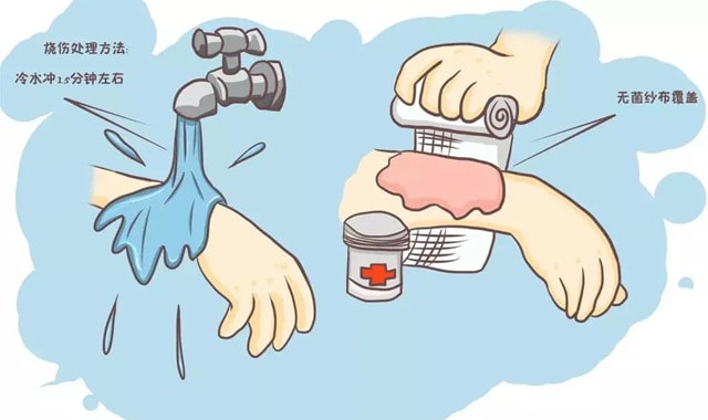 宝宝烫伤后如何处理