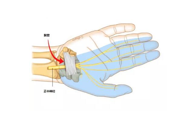 产后手腕疼？新手妈妈的「职业病」