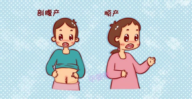 顺产和剖腹产的利弊各是什么