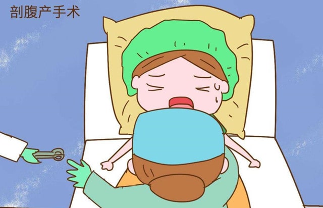 顺产和剖腹产的利弊各是什么