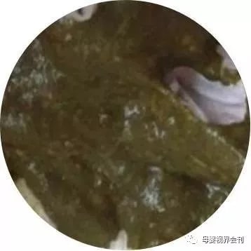 宝宝拉绿色大便怎么回事及应对方法