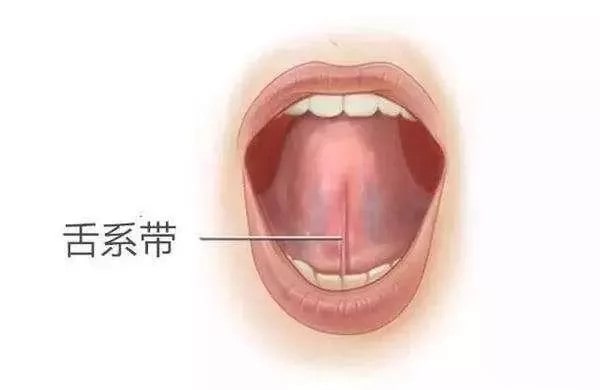 宝宝舌系带过短，一定要手术吗？