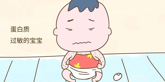 宝宝牛奶蛋白过敏的症状