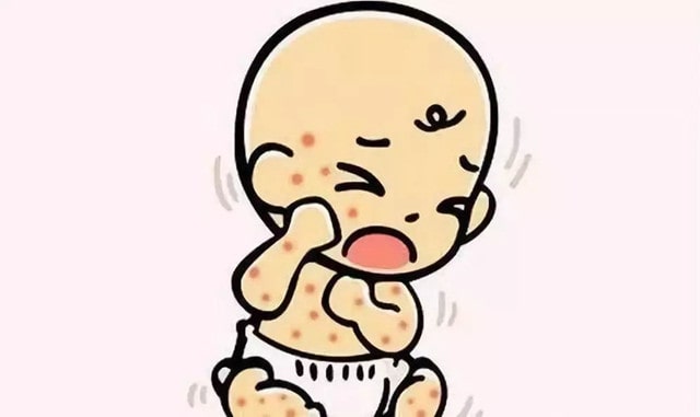 宝宝湿疹怎么办
