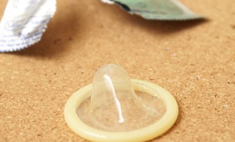 女性vs男性结扎的好处和坏处