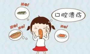 口腔溃疡怎么治好的最快