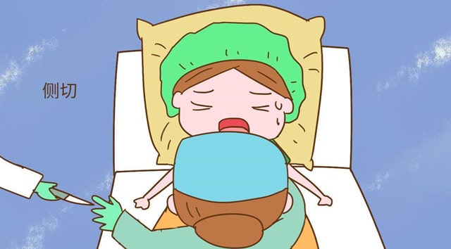 顺产会阴侧切伤口的护理