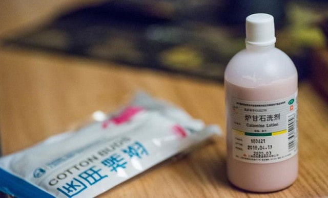 炉甘石洗剂对宝宝的作用