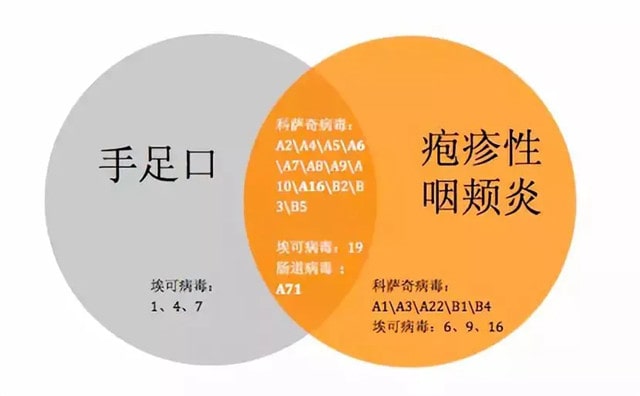 疱疹性咽峡炎高发，如何防治？