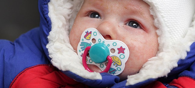 婴儿湿疹最怕三件事