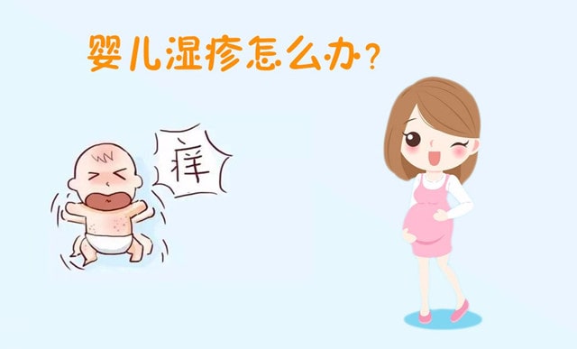 婴儿湿疹的类型 宝宝湿疹怎么办